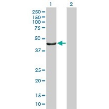 Anti-PTPN2 antibody produced in mouse，50UG，SAB1406343-50UG，Sigma