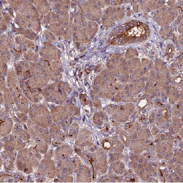 Anti-ZNF598 antibody produced in rabbit，100UL，HPA041896-100UL，Sigma