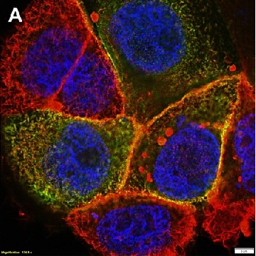 Anti-CFTR Antibody, clone MM13-4 ZooMAb® Mouse Monoclonal，4X25UL，ZMS1078-4X25UL，Sigma