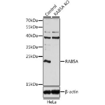 Anti-RAB5A antibody produced in rabbit，100UL，SAB5700060-100UL，Sigma