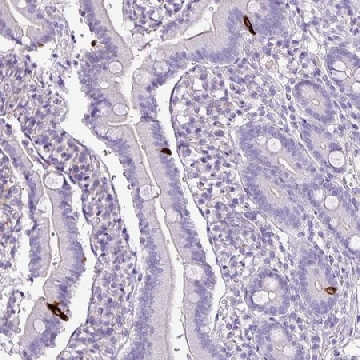 Anti-ZNF334 antibody produced in rabbit，100UL，HPA050022-100UL，Sigma