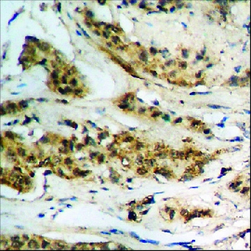 Anti-phospho-Tau (pThr¹⁸¹) antibody produced in rabbit，100UG，SAB4504560-100UG，Sigma
