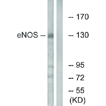 Anti-ENOS antibody produced in rabbit，100UG，SAB4502013-100UG，Sigma