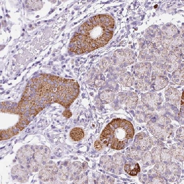 Anti-PLPP2 antibody produced in rabbit，100UL，HPA055540-100UL，Sigma