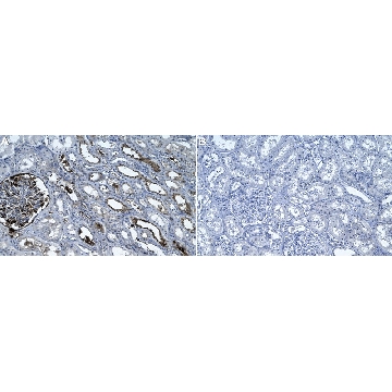 Anti-Fibrin Antibody, clone 59D8 ZooMAb® Mouse Monoclonal，，ZMS1211-4X25UL，Sigma