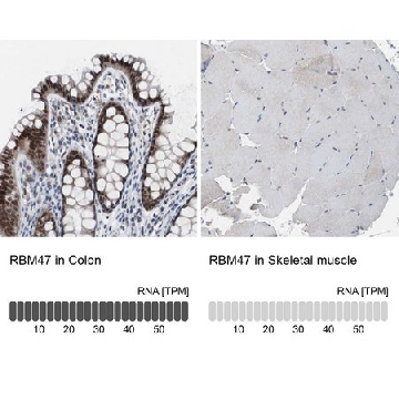 Anti-RBM47 antibody produced in rabbit，100UL，HPA006347-100UL，Sigma