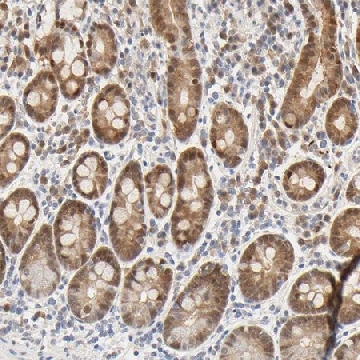 Anti-ACSS2 antibody produced in rabbit，100UL，HPA004141-100UL，Sigma