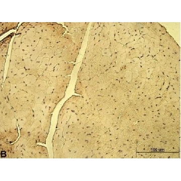 Anti-CD46 antibody produced in rabbit，100UL，HPA016903-100UL，Sigma