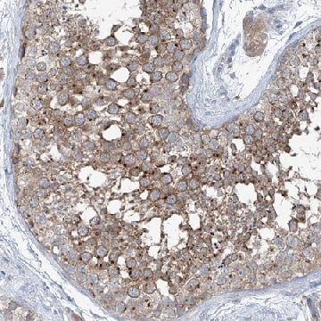 Anti-SLC12A6 antibody produced in rabbit，100UL，HPA034563-100UL，Sigma