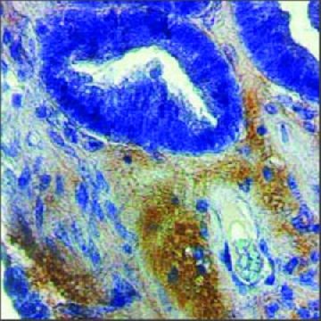 抗-MMP2，100UL，SAB2108458-100UL，Sigma