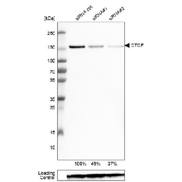 Monoclonal Anti-CTCF antibody produced in mouse，100UL，AMAB90663-100UL，Sigma