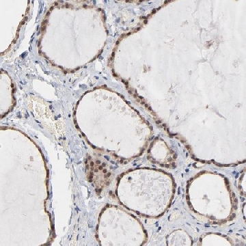 Anti-MSL2 antibody produced in rabbit，100UL，HPA003413-100UL，Sigma