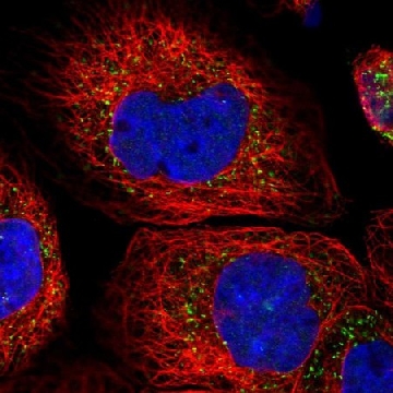 Anti-ACOX3 antibody produced in rabbit，100UL，HPA035840-100UL，Sigma