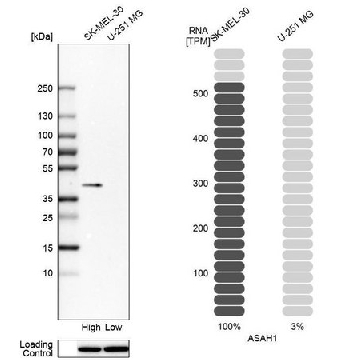 Anti-ASAH1 antibody produced in rabbit，100UL，HPA005468-100UL，Sigma