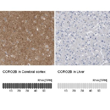抗-CORO2B 兔抗，100UL，HPA017960-100UL，Sigma