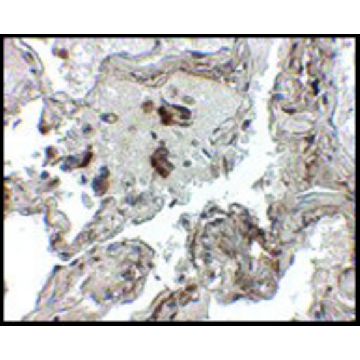 Anti-Transthyretin antibody produced in chicken，100UG，SAB3500378-100UG，Sigma