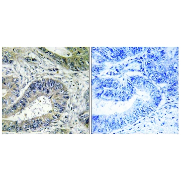 Anti-ERN2 antibody produced in rabbit，100UG，SAB4500133-100UG，Sigma