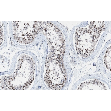 Anti-METTL14 Antibody, clone 2G22 ZooMAb® Rabbit Monoclonal，4X25UL，ZRB1339-4X25UL，Sigma