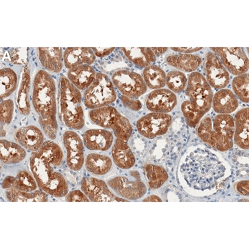 Anti-Cdc42 Antibody, clone 2D16 ZooMAb® Rabbit Monoclonal，25UL，ZRB1848-25UL，Sigma