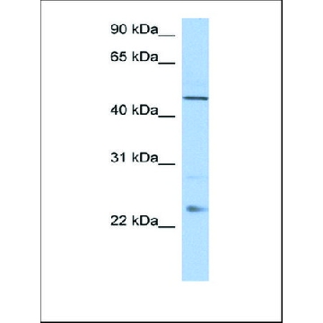抗-TMCO1 兔抗，100UL，AV49429-100UL，Sigma