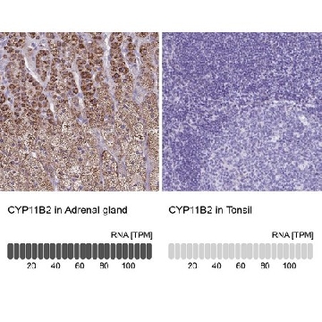 Anti-CYP11B2 antibody produced in rabbit，100UL，HPA049171-100UL，Sigma