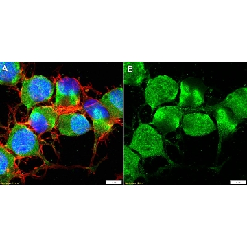 Anti-CRFR1/CRHR1 Antibody, clone 1N21 ZooMAb® Rabbit Monoclonal，，ZRB2302-4X25UL，Sigma