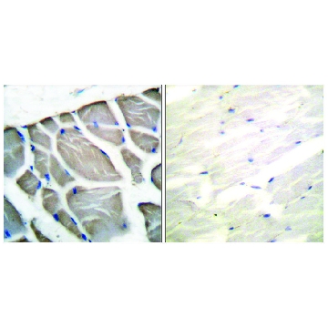 Anti-Actin-pan, C-Terminal antibody produced in rabbit，100UG，SAB4502632-100UG，Sigma