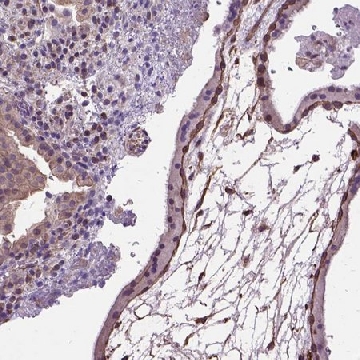 Anti-AREG antibody produced in rabbit，100UL，HPA008720-100UL，Sigma