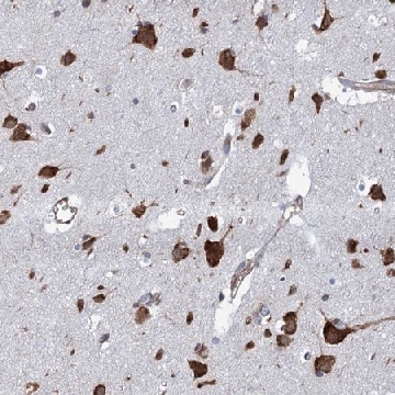 Anti-SLC12A7 antibody produced in rabbit，100UL，HPA041652-100UL，Sigma