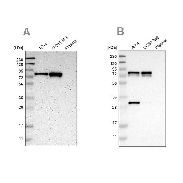 Anti-MTDH antibody produced in rabbit，100UL，HPA010932-100UL，Sigma