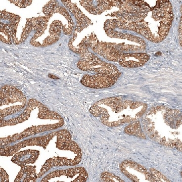Anti-F8A1 antibody produced in rabbit，100UL，HPA046960-100UL，Sigma