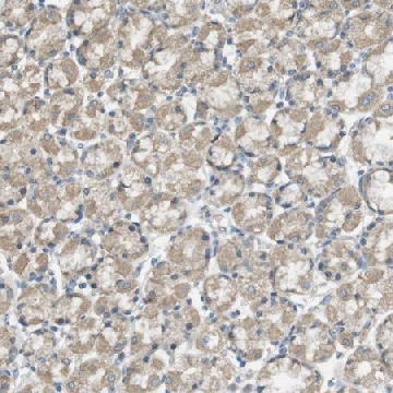 Anti-ZDHHC20 antibody produced in rabbit，100UL，HPA014702-100UL，Sigma