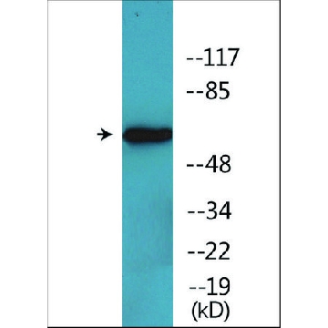 Anti-phospho-RIPK2 (pSer¹⁷⁶) antibody produced in rabbit，100UG，SAB4504642-100UG，Sigma