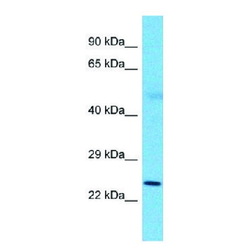 Anti-SLC25A26 (N-terminal) antibody produced in rabbit，100UL，SAB2109046-100UL，Sigma