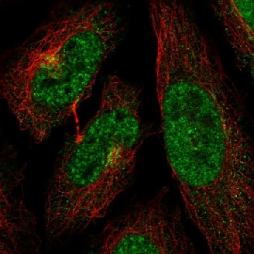 Anti-CDK13 antibody produced in rabbit，100UL，HPA059241-100UL，Sigma
