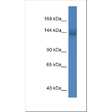 Anti-TMEM2 antibody produced in rabbit，100UL，SAB2106587-100UL，Sigma