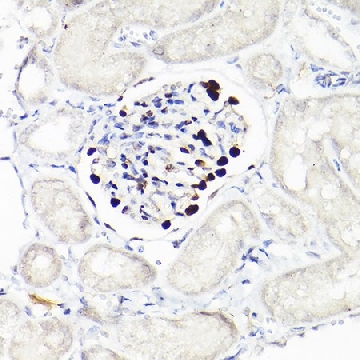 Anti-WT1 Antibody, clone 6L9X6, Rabbit Monoclonal，100UL，SAB5702311-100UL，Sigma