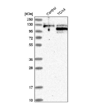Anti-TOX4 antibody produced in rabbit，100UL，HPA027551-100UL，Sigma