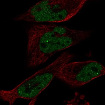 Anti-EYA1 antibody produced in rabbit，100UL，HPA028917-100UL，Sigma