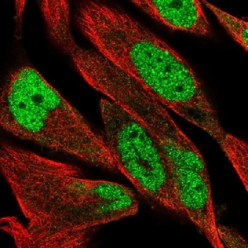 Anti-DCLRE1B antibody produced in rabbit，100UL，HPA064934-100UL，Sigma