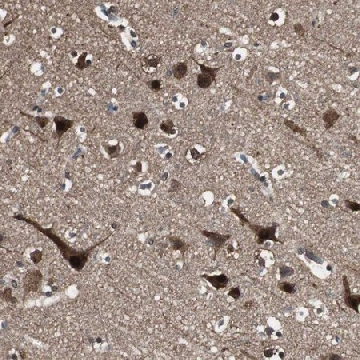 Anti-PPP1R13B antibody produced in rabbit，100UL，HPA006394-100UL，Sigma