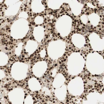 Anti-RNF113A antibody produced in rabbit，100UL，HPA000160-100UL，Sigma