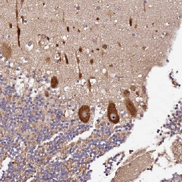Anti-DDX27 antibody produced in rabbit，100UL，HPA047087-100UL，Sigma