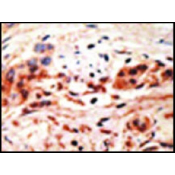 Anti-PHO1 (N-term) antibody produced in rabbit，100UG，SAB1300180-100UG，Sigma