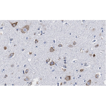 Anti-CGRP-1 Antibody, clone 2E18 ZooMAb® Rabbit Monoclonal，4X25UL，ZRB1267-4X25UL，Sigma