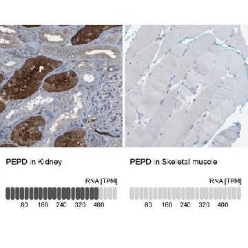 Anti-PEPD antibody produced in rabbit，100UL，HPA015599-100UL，Sigma