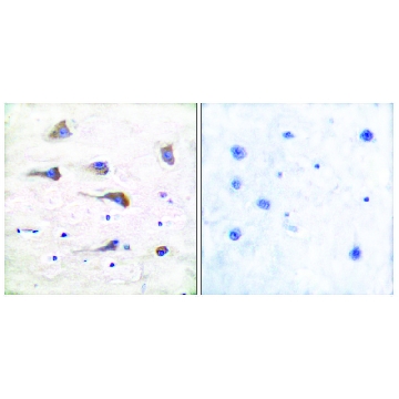 Anti-MGLUR6 antibody produced in rabbit，100UG，SAB4501324-100UG，Sigma