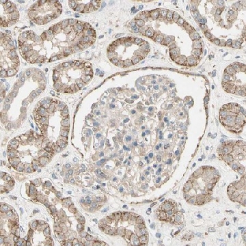 Anti-CDH6 antibody produced in rabbit，100UL，HPA007456-100UL，Sigma