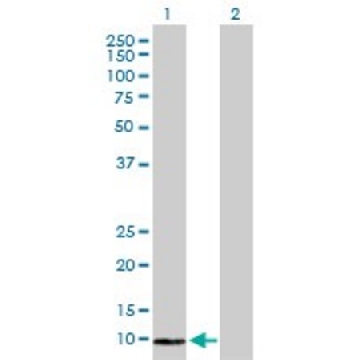 Anti-COX6B2 antibody produced in rabbit，100UG，SAB1401983-100UG，Sigma
