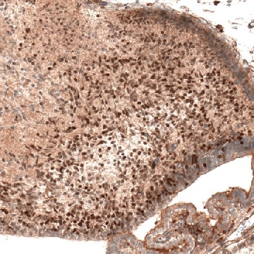 Monoclonal Anti-AUTS2 antibody produced in mouse，100UL，AMAB91455-100UL，Sigma